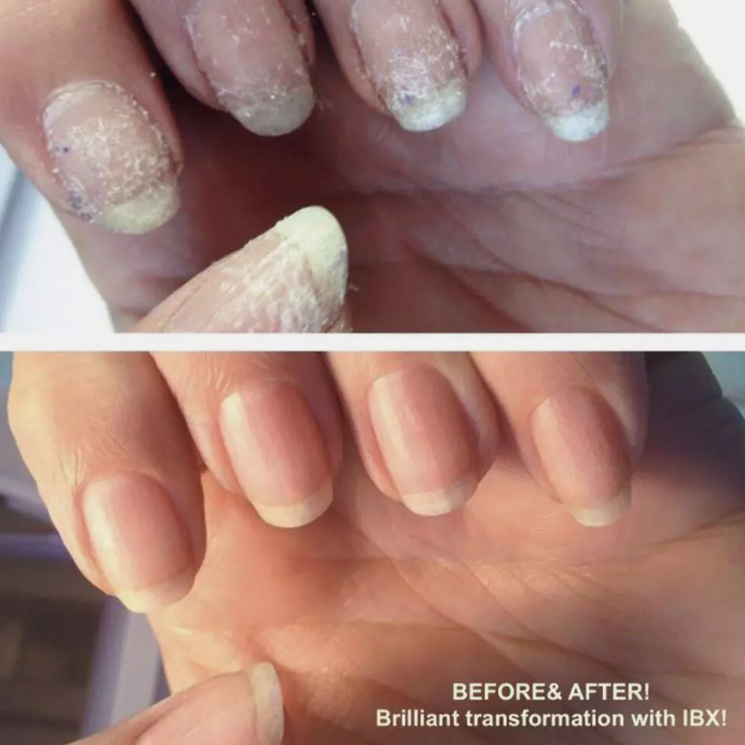 IBX DUO PACK - Natural Nail Strengthening + Repair Treatment